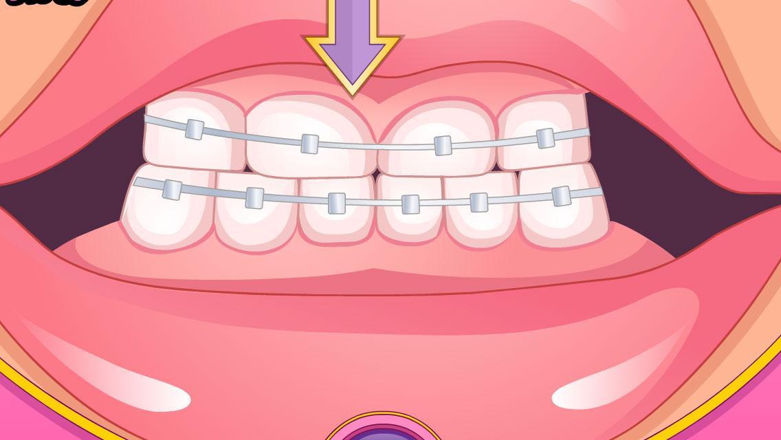 Bad Teeth Makeover