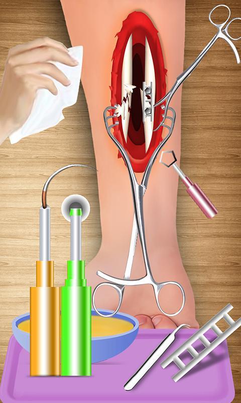 Arm Bone Doctor: Hospital Games & Surgery Games