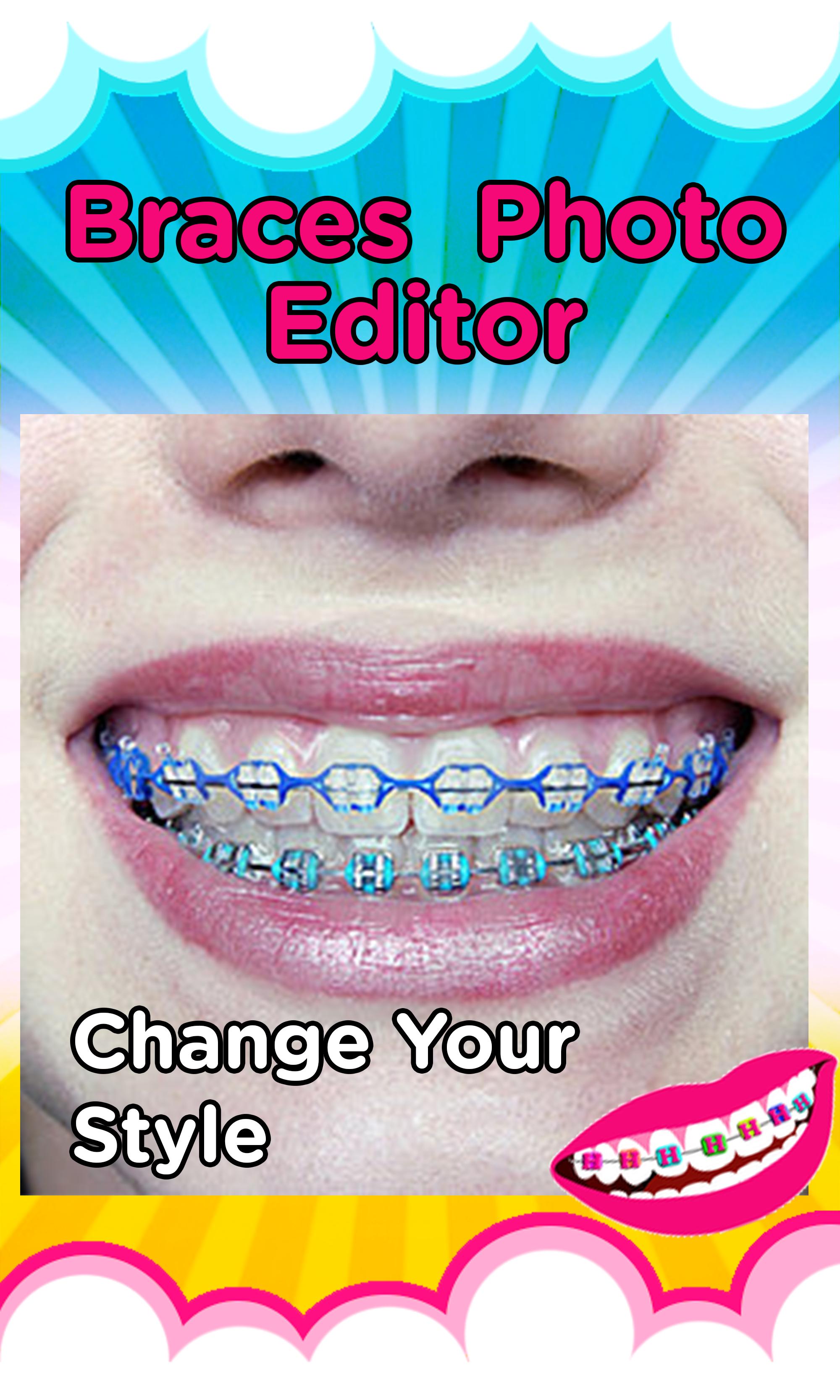 Teeth Braces Sticker Editor