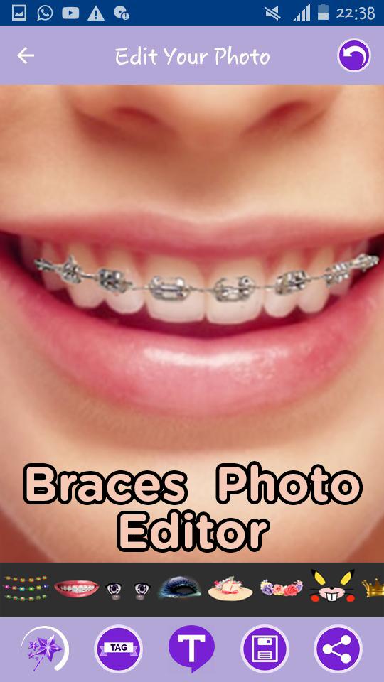 Teeth Braces Sticker Editor