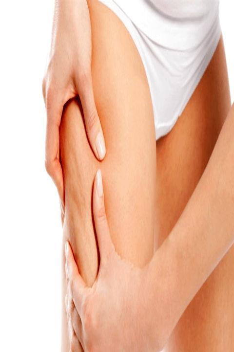 cellulite treatment at home